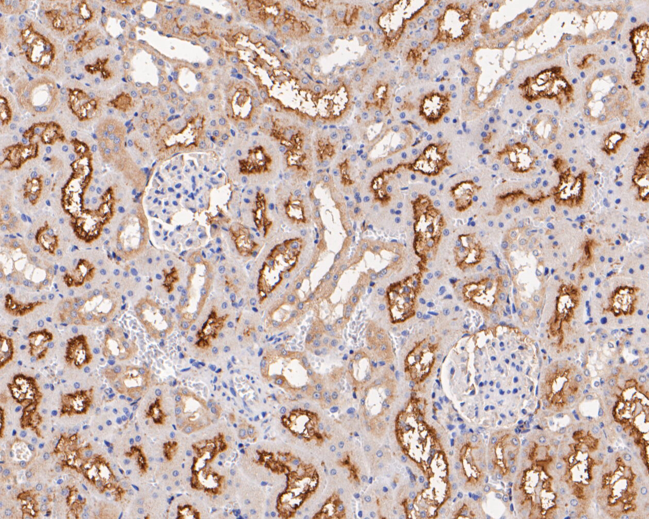 Immunohistochemical analysis of paraffin-embedded rat kidney tissue using anti-GABRB1 antibody. The section was pre-treated using heat mediated antigen retrieval with Tris-EDTA buffer (pH 8.0-8.4) for 20 minutes.The tissues were blocked in 5% BSA for 30 minutes at room temperature, washed with ddH2O and PBS, and then probed with the primary antibody (ER1901-66, 1/50) for 30 minutes at room temperature. The detection was performed using an HRP conjugated compact polymer system. DAB was used as the chromogen. Tissues were counterstained with hematoxylin and mounted with DPX.