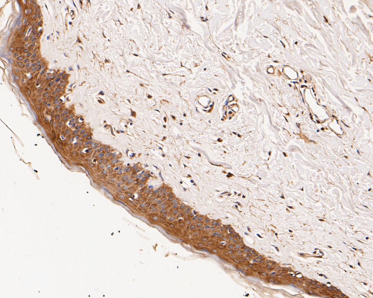 Immunohistochemical analysis of paraffin-embedded human skin tissue using anti-GABRB1 antibody. The section was pre-treated using heat mediated antigen retrieval with Tris-EDTA buffer (pH 8.0-8.4) for 20 minutes.The tissues were blocked in 5% BSA for 30 minutes at room temperature, washed with ddH2O and PBS, and then probed with the primary antibody (ER1901-66, 1/50) for 30 minutes at room temperature. The detection was performed using an HRP conjugated compact polymer system. DAB was used as the chromogen. Tissues were counterstained with hematoxylin and mounted with DPX.