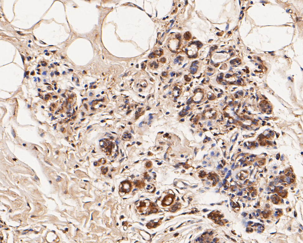Immunohistochemical analysis of paraffin-embedded human breast tissue using anti-GABRB1 antibody. The section was pre-treated using heat mediated antigen retrieval with Tris-EDTA buffer (pH 8.0-8.4) for 20 minutes.The tissues were blocked in 5% BSA for 30 minutes at room temperature, washed with ddH2O and PBS, and then probed with the primary antibody (ER1901-66, 1/50) for 30 minutes at room temperature. The detection was performed using an HRP conjugated compact polymer system. DAB was used as the chromogen. Tissues were counterstained with hematoxylin and mounted with DPX.