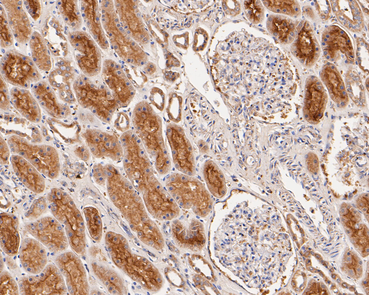 Immunohistochemical analysis of paraffin-embedded human kidney tissue using anti-GABRB1 antibody. The section was pre-treated using heat mediated antigen retrieval with Tris-EDTA buffer (pH 8.0-8.4) for 20 minutes.The tissues were blocked in 5% BSA for 30 minutes at room temperature, washed with ddH2O and PBS, and then probed with the primary antibody (ER1901-66, 1/50) for 30 minutes at room temperature. The detection was performed using an HRP conjugated compact polymer system. DAB was used as the chromogen. Tissues were counterstained with hematoxylin and mounted with DPX.