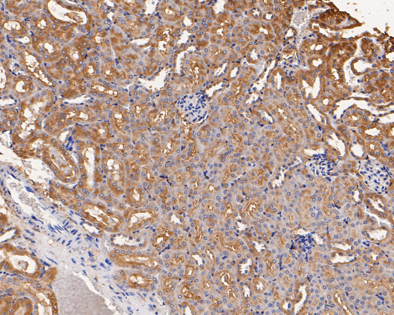 Immunohistochemical analysis of paraffin-embedded mouse kidney tissue using anti-GABRB1 antibody. The section was pre-treated using heat mediated antigen retrieval with Tris-EDTA buffer (pH 8.0-8.4) for 20 minutes.The tissues were blocked in 5% BSA for 30 minutes at room temperature, washed with ddH2O and PBS, and then probed with the primary antibody (ER1901-66, 1/50) for 30 minutes at room temperature. The detection was performed using an HRP conjugated compact polymer system. DAB was used as the chromogen. Tissues were counterstained with hematoxylin and mounted with DPX.