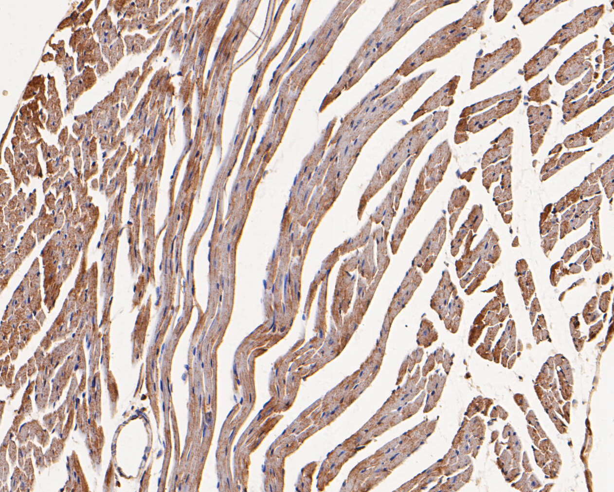 Immunohistochemical analysis of paraffin-embedded mouse heart tissue using anti-GABRB1 antibody. The section was pre-treated using heat mediated antigen retrieval with Tris-EDTA buffer (pH 8.0-8.4) for 20 minutes.The tissues were blocked in 5% BSA for 30 minutes at room temperature, washed with ddH2O and PBS, and then probed with the primary antibody (ER1901-66, 1/50) for 30 minutes at room temperature. The detection was performed using an HRP conjugated compact polymer system. DAB was used as the chromogen. Tissues were counterstained with hematoxylin and mounted with DPX.