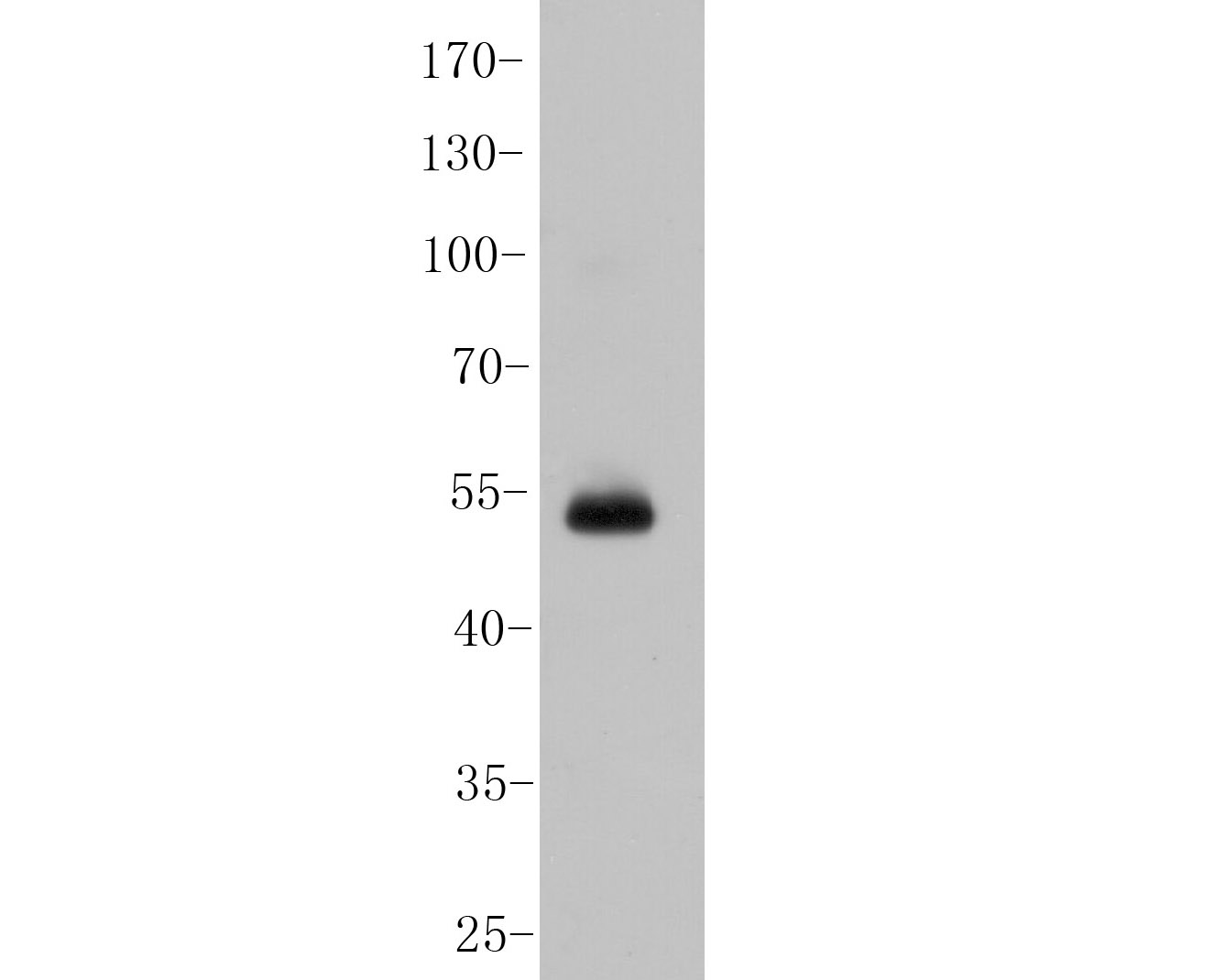 Western blot analysis of USP21 on SHSY5Y cell  lysates. Proteins were transferred to a PVDF membrane and blocked with 5% BSA in PBS for 1 hour at room temperature. The primary antibody (ER1901-67, 1/1000) was used in 5% BSA at room temperature for 2 hours. Goat Anti-Rabbit IgG - HRP Secondary Antibody (HA1001) at 1:5,000 dilution was used for 1 hour at room temperature.