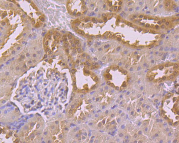 Immunohistochemical analysis of paraffin-embedded Rat kidney tissue using anti-USP21 antibody. The section was pre-treated using heat mediated antigen retrieval with Tris-EDTA buffer (pH 8.0-8.4) for 20 minutes.The tissues were blocked in 5% BSA for 30 minutes at room temperature, washed with ddH2O and PBS, and then probed with the primary antibody (ER1901-67, 1/100) for 30 minutes at room temperature. The detection was performed using an HRP conjugated compact polymer system. DAB was used as the chromogen. Tissues were counterstained with hematoxylin and mounted with DPX.