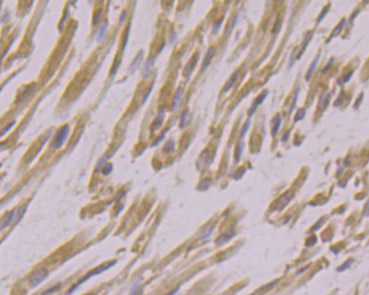 Immunohistochemical analysis of paraffin-embedded human fetal skeletal muscle tissue using anti-USP21 antibody. The section was pre-treated using heat mediated antigen retrieval with Tris-EDTA buffer (pH 8.0-8.4) for 20 minutes.The tissues were blocked in 5% BSA for 30 minutes at room temperature, washed with ddH2O and PBS, and then probed with the primary antibody (ER1901-67, 1/100) for 30 minutes at room temperature. The detection was performed using an HRP conjugated compact polymer system. DAB was used as the chromogen. Tissues were counterstained with hematoxylin and mounted with DPX.