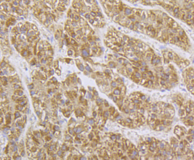 Immunohistochemical analysis of paraffin-embedded human liver tissue using anti-SPATA5L1 antibody. The section was pre-treated using heat mediated antigen retrieval with Tris-EDTA buffer (pH 8.0-8.4) for 20 minutes.The tissues were blocked in 5% BSA for 30 minutes at room temperature, washed with ddH2O and PBS, and then probed with the primary antibody (ER1901-68, 1/100) for 30 minutes at room temperature. The detection was performed using an HRP conjugated compact polymer system. DAB was used as the chromogen. Tissues were counterstained with hematoxylin and mounted with DPX.
