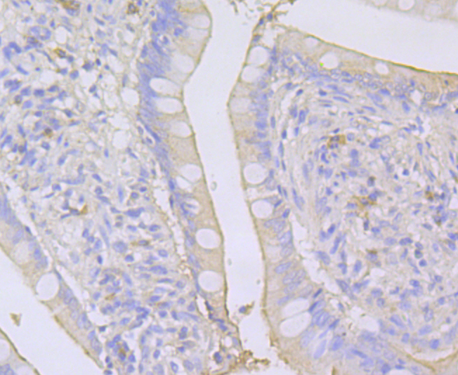 Immunohistochemical analysis of paraffin-embedded Human small intestine tissue using anti-SPATA5L1 antibody. The section was pre-treated using heat mediated antigen retrieval with Tris-EDTA buffer (pH 8.0-8.4) for 20 minutes.The tissues were blocked in 5% BSA for 30 minutes at room temperature, washed with ddH2O and PBS, and then probed with the primary antibody (ER1901-68, 1/100) for 30 minutes at room temperature. The detection was performed using an HRP conjugated compact polymer system. DAB was used as the chromogen. Tissues were counterstained with hematoxylin and mounted with DPX.