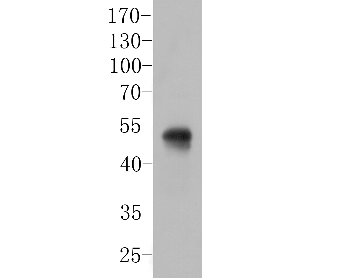 Western blot analysis of Follistatin on Rat colon tissue  lysates. Proteins were transferred to a PVDF membrane and blocked with 5% BSA in PBS for 1 hour at room temperature. The primary antibody (ER1901-69, 1/500) was used in 5% BSA at room temperature for 2 hours. Goat Anti-Rabbit IgG - HRP Secondary Antibody (HA1001) at 1:5,000 dilution was used for 1 hour at room temperature.