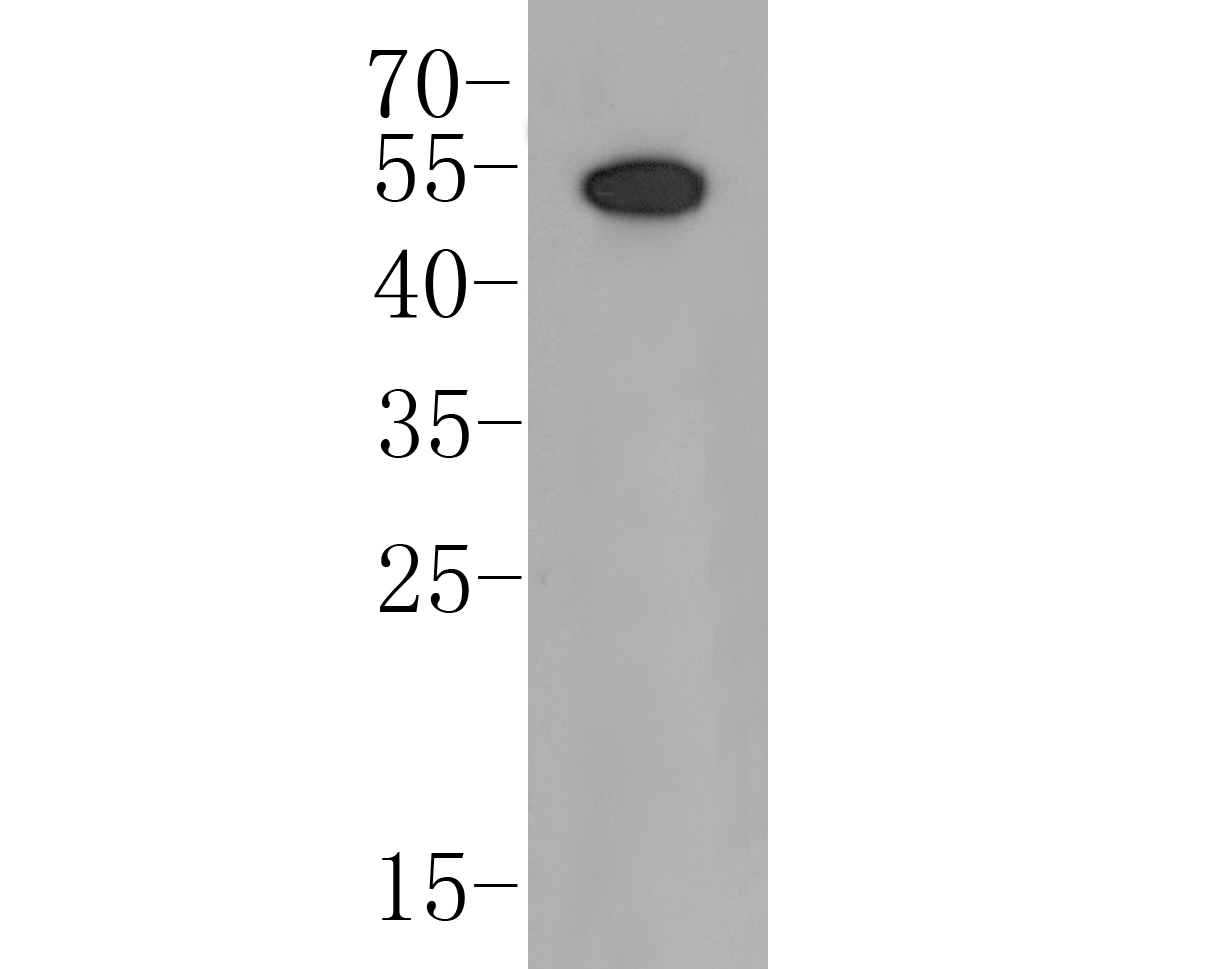 Western blot analysis of Follistatin on Raji cell lysates. Proteins were transferred to a PVDF membrane and blocked with 5% BSA in PBS for 1 hour at room temperature. The primary antibody (ER1901-69, 1/500) was used in 5% BSA at room temperature for 2 hours. Goat Anti-Rabbit IgG - HRP Secondary Antibody (HA1001) at 1:5,000 dilution was used for 1 hour at room temperature.