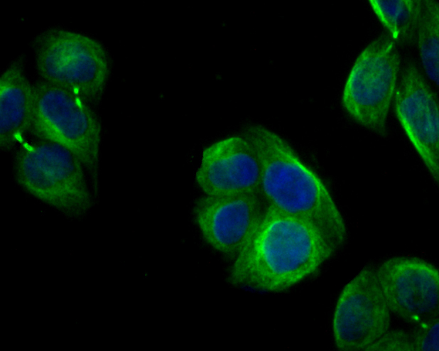 ICC staining of Follistatin  in Hela cells (green). Formalin fixed cells were permeabilized with 0.1% Triton X-100 in TBS for 10 minutes at room temperature and blocked with 1% Blocker BSA for 15 minutes at room temperature. Cells were probed with the primary antibody (ER1901-69, 1/100) for 1 hour at room temperature, washed with PBS. Alexa Fluor®488 Goat anti-Rabbit IgG was used as the secondary antibody at 1/100 dilution. The nuclear counter stain is DAPI (blue).