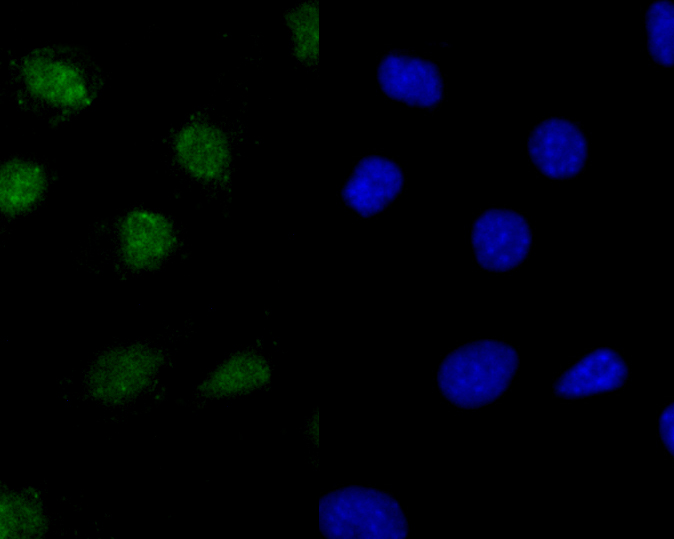 ICC staining of Histone H2A.x in SHSY5Y cells (green). Formalin fixed cells were permeabilized with 0.1% Triton X-100 in TBS for 10 minutes at room temperature and blocked with 1% Blocker BSA for 15 minutes at room temperature. Cells were probed with the primary antibody (ER1901-70, 1/100) for 1 hour at room temperature, washed with PBS. Alexa Fluor®488 Goat anti-Rabbit IgG was used as the secondary antibody at 1/100 dilution. The nuclear counter stain is DAPI (blue).