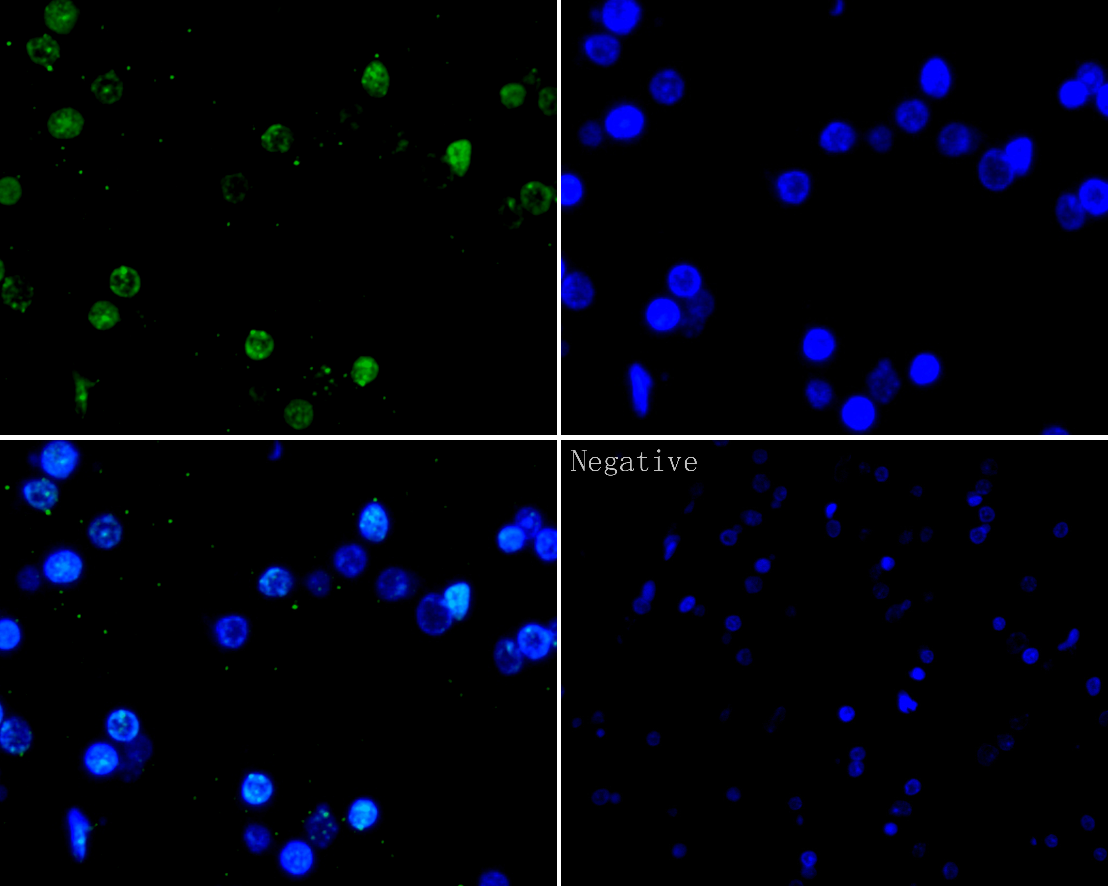 Immunofluorescence analysis of paraffin-embedded rat brain using anti-Histone H2A.x antibody. The section was pre-treated using heat mediated antigen retrieval with Tris-EDTA buffer (pH 8.0-8.4) for 20 minutes.The tissues were blocked in 5% BSA for 30 minutes at room temperature , washed with ddH2O and PBS, and then probed with the primary antibody (ER1901-70, 1/100) at 4 ° C overnight. Alexa Fluor®488 Goat anti-Rabbit IgG was used as the secondary antibody at 1/100 dilution. The nuclear counter stain is DAPI (blue)。