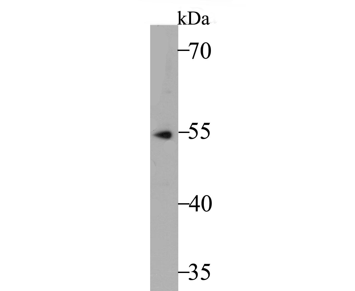 Western blot analysis of Fascin on SH-SY5Y cell lysate. Proteins were transferred to a PVDF membrane and blocked with 5% BSA in PBS for 1 hour at room temperature. The primary antibody was used at a 1:500 dilution in 5% BSA at room temperature for 2 hours. Goat Anti-Rabbit IgG - HRP Secondary Antibody (HA1001) at 1:5,000 dilution was used for 1 hour at room temperature.