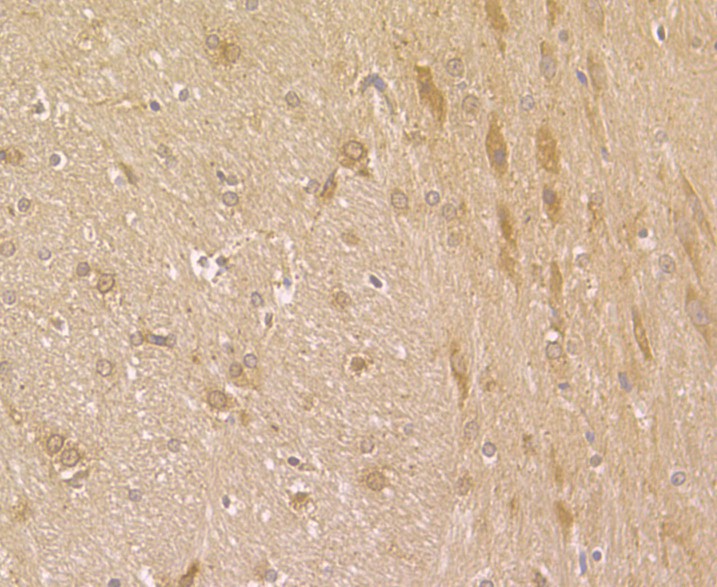 Immunohistochemical analysis of paraffin-embedded rat brain tissue using anti-Fascin antibody. The section was pre-treated using heat mediated antigen retrieval with Tris-EDTA buffer (pH 8.0-8.4) for 20 minutes.The tissues were blocked in 5% BSA for 30 minutes at room temperature, washed with ddH2O and PBS, and then probed with the antibody (ER1901-71) at 1/50 dilution, for 30 minutes at room temperature and detected using an HRP conjugated compact polymer system. DAB was used as the chromogen. Counter stained with hematoxylin and mounted with DPX.