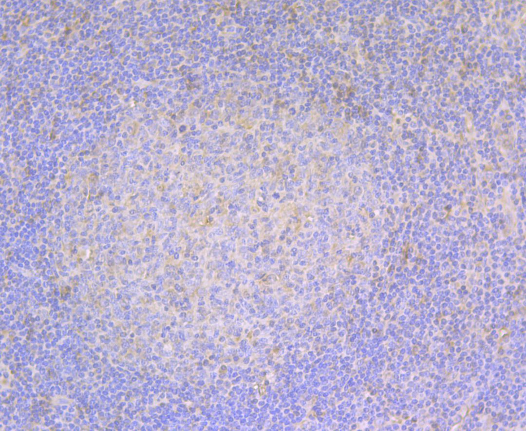 Immunohistochemical analysis of paraffin-embedded human tonsil tissue using anti-Fascin antibody. The section was pre-treated using heat mediated antigen retrieval with Tris-EDTA buffer (pH 8.0-8.4) for 20 minutes.The tissues were blocked in 5% BSA for 30 minutes at room temperature, washed with ddH2O and PBS, and then probed with the antibody (ER1901-71) at 1/200 dilution, for 30 minutes at room temperature and detected using an HRP conjugated compact polymer system. DAB was used as the chromogen. Counter stained with hematoxylin and mounted with DPX.