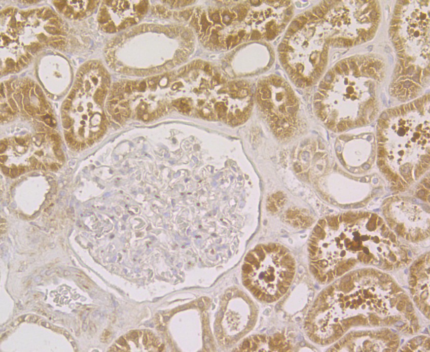Immunohistochemical analysis of paraffin-embedded human kidney tissue using anti-Fascin antibody. The section was pre-treated using heat mediated antigen retrieval with Tris-EDTA buffer (pH 8.0-8.4) for 20 minutes.The tissues were blocked in 5% BSA for 30 minutes at room temperature, washed with ddH2O and PBS, and then probed with the antibody (ER1901-71) at 1/200 dilution, for 30 minutes at room temperature and detected using an HRP conjugated compact polymer system. DAB was used as the chromogen. Counter stained with hematoxylin and mounted with DPX.