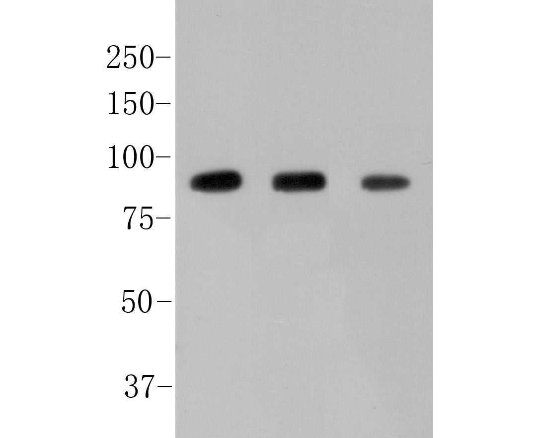 Western blot analysis of Alpha-dystroglycan on different lysates. Proteins were transferred to a PVDF membrane and blocked with 5% BSA in PBS for 1 hour at room temperature. The primary antibody (ER1901-72, 1/1000) was used in 5% BSA at room temperature for 2 hours. Goat Anti-Rabbit IgG - HRP Secondary Antibody (HA1001) at 1:5,000 dilution was used for 1 hour at room temperature.<br />
Positive control: <br />
Lane 1: SkBr3 cell lysate<br />
Lane 2: Mouse placenta tissue  lysate<br />
Lane3: Siha cell lysate