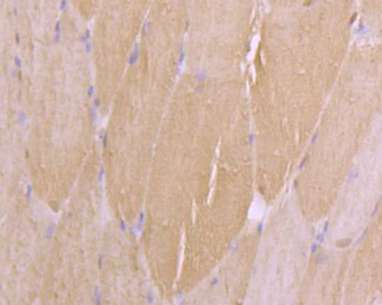 Immunohistochemical analysis of paraffin-embedded Rat skeletal muscle tissue using anti-Alpha-dystroglycan antibody. The section was pre-treated using heat mediated antigen retrieval with sodium citrate buffer (pH 6.0) for 20 minutes. The tissues were blocked in 5% BSA for 30 minutes at room temperature, washed with ddH2O and PBS, and then probed with the primary antibody (ER1901-72, 1/100)  for 30 minutes at room temperature. The detection was performed using an HRP conjugated compact polymer system. DAB was used as the chromogen. Tissues were counterstained with hematoxylin and mounted with DPX.