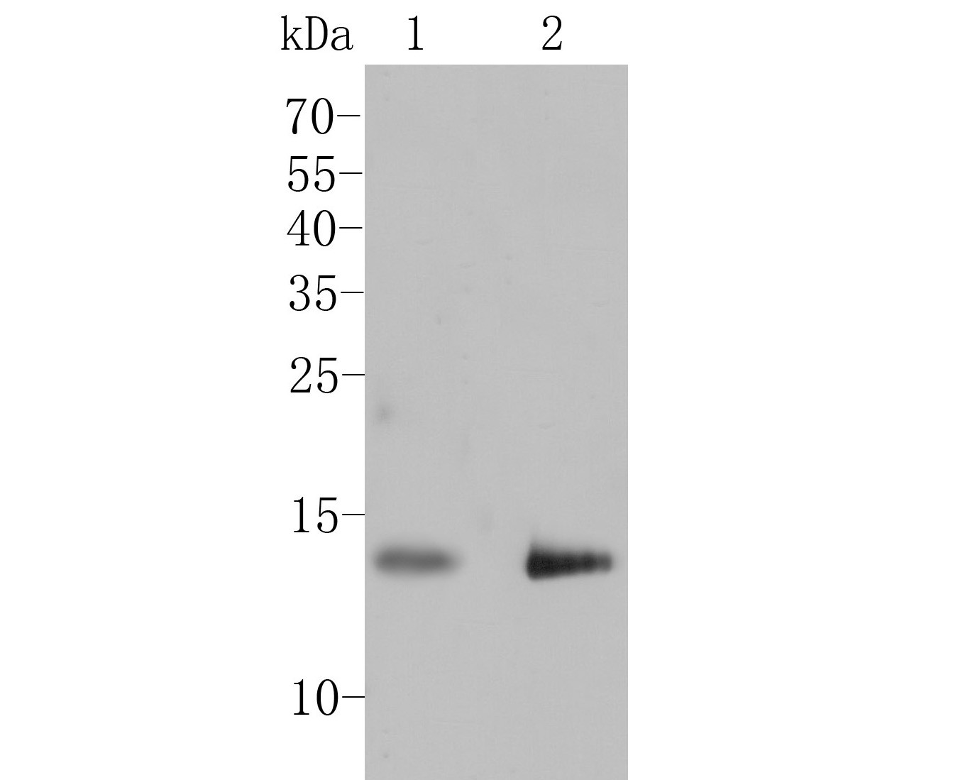 Western blot analysis of GABARAPL2 on different lysates. Proteins were transferred to a PVDF membrane and blocked with 5% BSA in PBS for 1 hour at room temperature. The primary antibody (ER1901-73, 1/100) was used in 5% BSA at room temperature for 2 hours. Goat Anti-Rabbit IgG - HRP Secondary Antibody (HA1001) at 1:5,000 dilution was used for 1 hour at room temperature.<br />
Positive control: <br />
Lane 1: 293 cell lysate<br />
Lane 2: SHSY5Y cell lysate