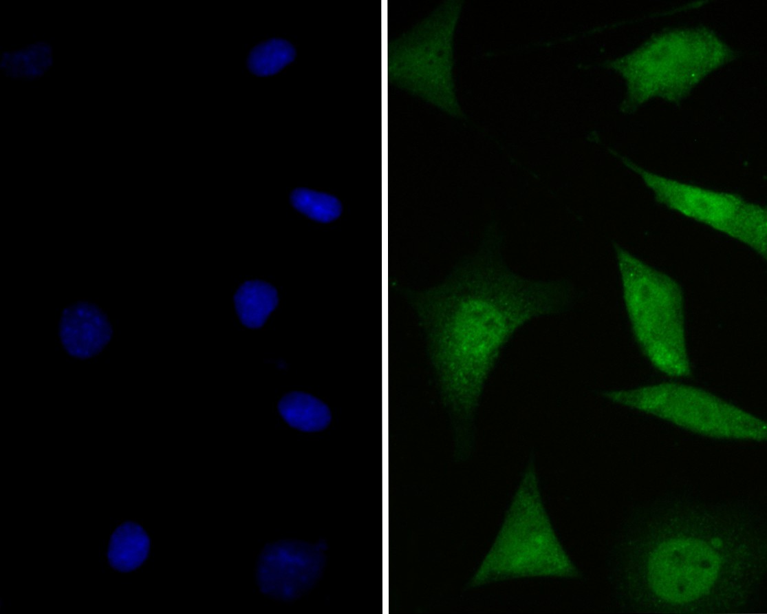 ICC staining of GABARAPL2 in SHSY5Y cells (green). Formalin fixed cells were permeabilized with 0.1% Triton X-100 in TBS for 10 minutes at room temperature and blocked with 1% Blocker BSA for 15 minutes at room temperature. Cells were probed with the primary antibody (ER1901-73, 1/100) for 1 hour at room temperature, washed with PBS. Alexa Fluor®488 Goat anti-Rabbit IgG was used as the secondary antibody at 1/100 dilution. The nuclear counter stain is DAPI (blue).