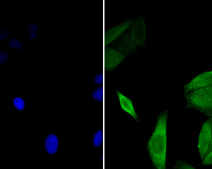 ICC staining of GABARAPL2 in Siha cells (green). Formalin fixed cells were permeabilized with 0.1% Triton X-100 in TBS for 10 minutes at room temperature and blocked with 1% Blocker BSA for 15 minutes at room temperature. Cells were probed with the primary antibody (ER1901-73, 1/100) for 1 hour at room temperature, washed with PBS. Alexa Fluor®488 Goat anti-Rabbit IgG was used as the secondary antibody at 1/100 dilution. The nuclear counter stain is DAPI (blue).