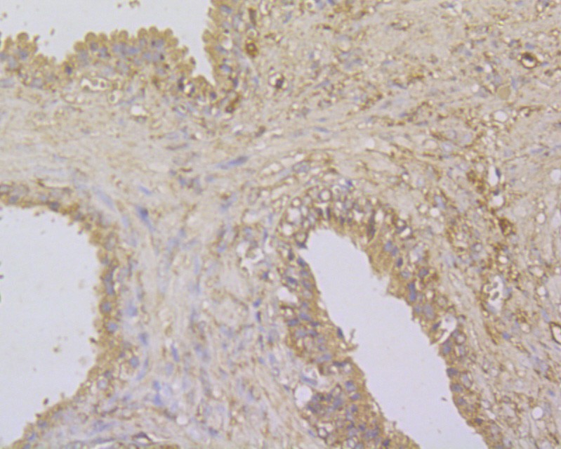 Immunohistochemical analysis of paraffin-embedded Human prostate tissue using anti-GABARAPL2 antibody. The section was pre-treated using heat mediated antigen retrieval with Tris-EDTA buffer (pH 9.0) for 20 minutes.The tissues were blocked in 5% BSA for 30 minutes at room temperature, washed with ddH2O and PBS, and then probed with the primary antibody (ER1901-73, 1/100) for 30 minutes at room temperature. The detection was performed using an HRP conjugated compact polymer system. DAB was used as the chromogen. Tissues were counterstained with hematoxylin and mounted with DPX.