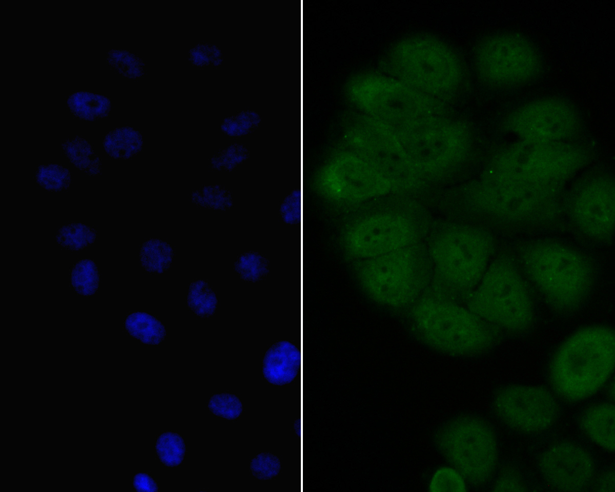 ICC staining of BCL-6 in HepG2 cells (green). Formalin fixed cells were permeabilized with 0.1% Triton X-100 in TBS for 10 minutes at room temperature and blocked with 1% Blocker BSA for 15 minutes at room temperature. Cells were probed with the primary antibody (ER1901-74, 1/100) for 1 hour at room temperature, washed with PBS. Alexa Fluor®488 Goat anti-Rabbit IgG was used as the secondary antibody at 1/100 dilution. The nuclear counter stain is DAPI (blue).