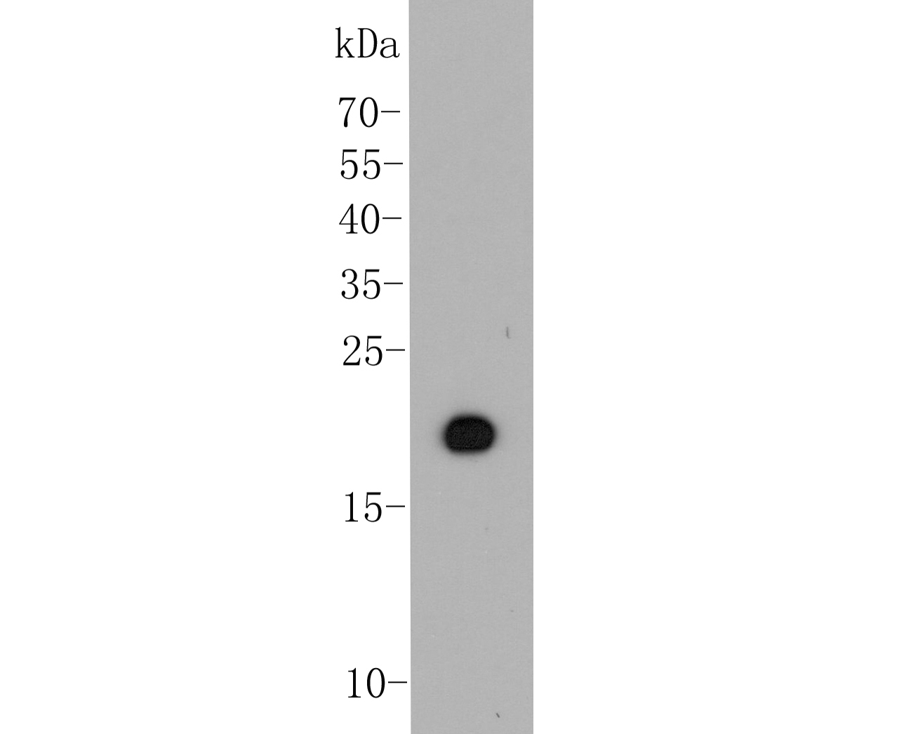 Western blot analysis of p15 INK4b on recombinant protein. Proteins were transferred to a PVDF membrane and blocked with 5% BSA in PBS for 1 hour at room temperature. The primary antibody (ER1901-75, 1/1,000) was used in 5% BSA at room temperature for 2 hours. Goat Anti-Rabbit IgG - HRP Secondary Antibody (HA1001) at 1:5,000 dilution was used for 1 hour at room temperature.