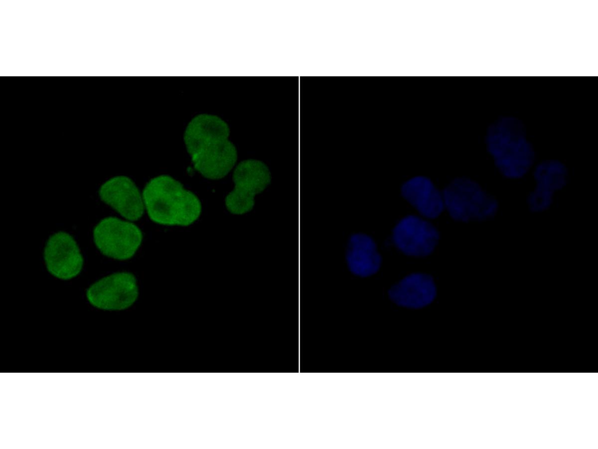 ICC staining p15 INK4b in Hela cells (green). Formalin fixed cells were permeabilized with 0.1% Triton X-100 in TBS for 10 minutes at room temperature and blocked with 1% Blocker BSA for 15 minutes at room temperature. Cells were probed with the antibody (ER1901-75) at a dilution of 1:200 for 1 hour at room temperature, washed with PBS. Alexa Fluorc™ 488 Goat anti-Rabbit IgG was used as the secondary antibody at 1/100 dilution. The nuclear counter stain is DAPI (blue).
