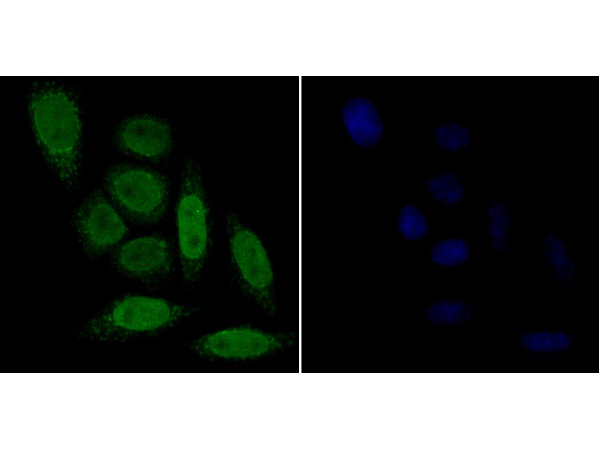 ICC staining p15 INK4b in SiHa cells (green). Formalin fixed cells were permeabilized with 0.1% Triton X-100 in TBS for 10 minutes at room temperature and blocked with 1% Blocker BSA for 15 minutes at room temperature. Cells were probed with the antibody (ER1901-75) at a dilution of 1:50 for 1 hour at room temperature, washed with PBS. Alexa Fluorc™ 488 Goat anti-Rabbit IgG was used as the secondary antibody at 1/100 dilution. The nuclear counter stain is DAPI (blue).