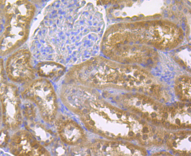 Immunohistochemical analysis of paraffin-embedded rat kidney tissue using anti-p15 INK4b antibody. The section was pre-treated using heat mediated antigen retrieval with Tris-EDTA buffer (pH 8.0-8.4) for 20 minutes.The tissues were blocked in 5% BSA for 30 minutes at room temperature, washed with ddH2O and PBS, and then probed with the antibody (ER1901-75) at 1/200 dilution, for 30 minutes at room temperature and detected using an HRP conjugated compact polymer system. DAB was used as the chromogen. Counter stained with hematoxylin and mounted with DPX.