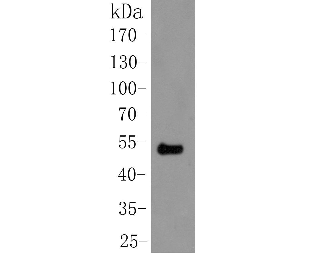 Western blot analysis of Cytokertin 20 on Human small intestine tissue lysate. Proteins were transferred to a PVDF membrane and blocked with 5% BSA in PBS for 1 hour at room temperature. The primary antibody (ER1901-76, 1/1000) was used in 5% BSA at room temperature for 2 hours. Goat Anti-Rabbit IgG - HRP Secondary Antibody (HA1001) at 1:5,000 dilution was used for 1 hour at room temperature.