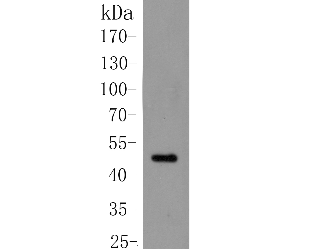 Western blot analysis of Cytokertin 20 on mouse colon tissue lysate. Proteins were transferred to a PVDF membrane and blocked with 5% BSA in PBS for 1 hour at room temperature. The primary antibody (ER1901-76, 1/1000) was used in 5% BSA at room temperature for 2 hours. Goat Anti-Rabbit IgG - HRP Secondary Antibody (HA1001) at 1:5,000 dilution was used for 1 hour at room temperature.