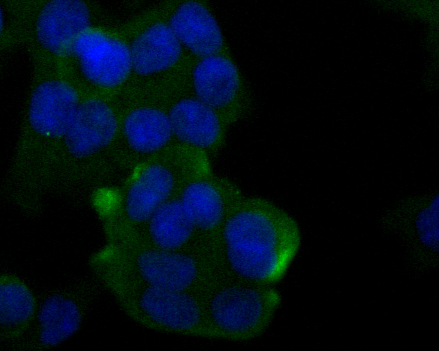 ICC staining of Cytokertin 20 in SW480 cells (green). Formalin fixed cells were permeabilized with 0.1% Triton X-100 in TBS for 10 minutes at room temperature and blocked with 1% Blocker BSA for 15 minutes at room temperature. Cells were probed with the primary antibody (ER1901-76, 1/100) for 1 hour at room temperature, washed with PBS. Alexa Fluor®488 Goat anti-Rabbit IgG was used as the secondary antibody at 1/100 dilution. The nuclear counter stain is DAPI (blue).