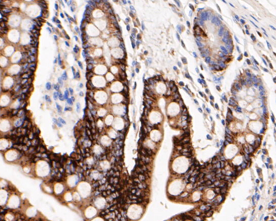 Immunohistochemical analysis of paraffin-embedded Human small intestine tissue using anti-Cytokertin 20 antibody. The section was pre-treated using heat mediated antigen retrieval with Tris-EDTA buffer (pH 8.0-8.4) for 20 minutes.The tissues were blocked in 5% BSA for 30 minutes at room temperature, washed with ddH2O and PBS, and then probed with the primary antibody (ER1901-76, 1/100) for 30 minutes at room temperature. The detection was performed using an HRP conjugated compact polymer system. DAB was used as the chromogen. Tissues were counterstained with hematoxylin and mounted with DPX.