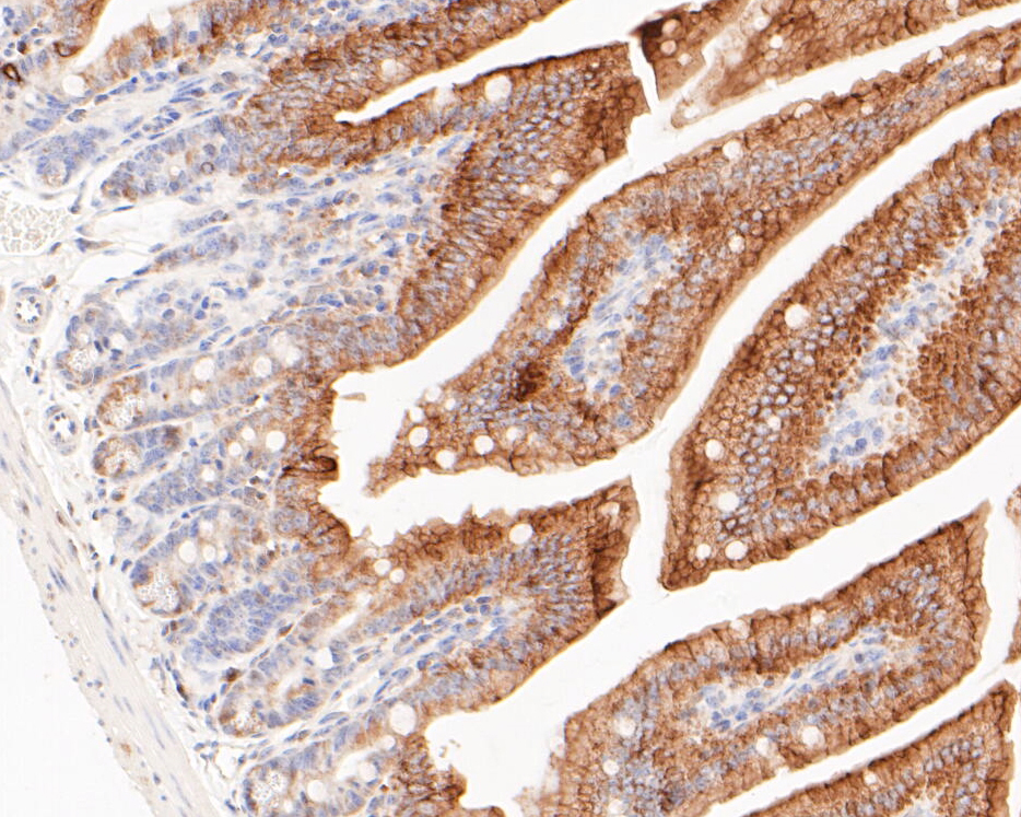 Immunohistochemical analysis of paraffin-embedded mouse colon tissue using anti-Cytokertin 20 antibody. The section was pre-treated using heat mediated antigen retrieval with Tris-EDTA buffer (pH 8.0-8.4) for 20 minutes.The tissues were blocked in 5% BSA for 30 minutes at room temperature, washed with ddH2O and PBS, and then probed with the primary antibody (ER1901-76, 1/100) for 30 minutes at room temperature. The detection was performed using an HRP conjugated compact polymer system. DAB was used as the chromogen. Tissues were counterstained with hematoxylin and mounted with DPX.