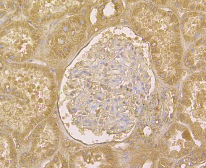 Immunohistochemical analysis of paraffin-embedded human kidney tissue using anti-TRADD antibody. The section was pre-treated using heat mediated antigen retrieval with Tris-EDTA buffer (pH 9.0) for 20 minutes.The tissues were blocked in 5% BSA for 30 minutes at room temperature, washed with ddH2O and PBS, and then probed with the antibody (ER1901-79) at 1/50 dilution, for 30 minutes at room temperature and detected using an HRP conjugated compact polymer system. DAB was used as the chromogen. Counter stained with hematoxylin and mounted with DPX.