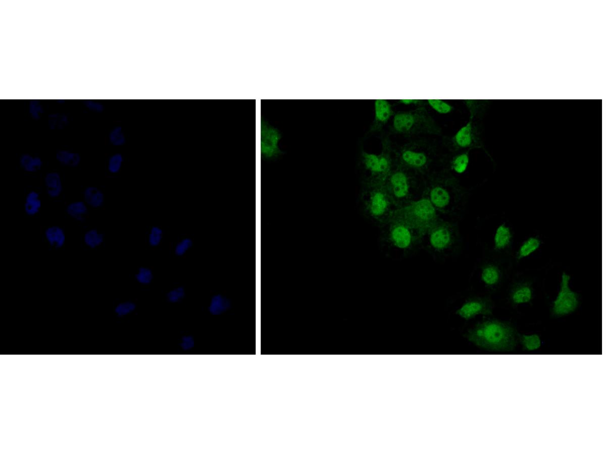 ICC staining of delta 1 Catenin/CAS in A431 cells (green). Formalin fixed cells were permeabilized with 0.1% Triton X-100 in TBS for 10 minutes at room temperature and blocked with 1% Blocker BSA for 15 minutes at room temperature. Cells were probed with the primary antibody (ER1901-80, 1/100) for 1 hour at room temperature, washed with PBS. Alexa Fluor®488 Goat anti-Rabbit IgG was used as the secondary antibody at 1/100 dilution. The nuclear counter stain is DAPI (blue).