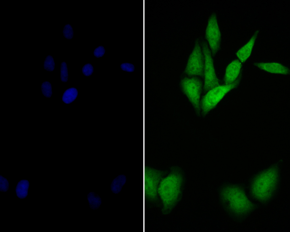 ICC staining of delta 1 Catenin/CAS in SiHa cells (green). Formalin fixed cells were permeabilized with 0.1% Triton X-100 in TBS for 10 minutes at room temperature and blocked with 1% Blocker BSA for 15 minutes at room temperature. Cells were probed with the primary antibody (ER1901-80, 1/100) for 1 hour at room temperature, washed with PBS. Alexa Fluor®488 Goat anti-Rabbit IgG was used as the secondary antibody at 1/100 dilution. The nuclear counter stain is DAPI (blue).