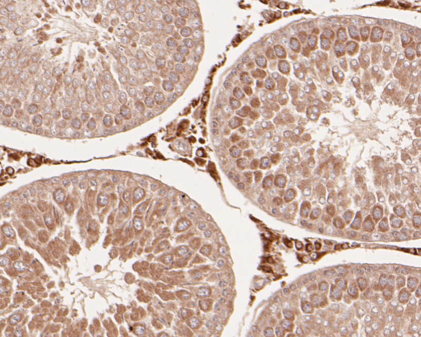 Immunohistochemical analysis of paraffin-embedded Rat testis tissue using anti-delta 1 Catenin/CAS antibody. The section was pre-treated using heat mediated antigen retrieval with Tris-EDTA buffer (pH 8.0-8.4) for 20 minutes.The tissues were blocked in 5% BSA for 30 minutes at room temperature, washed with ddH2O and PBS, and then probed with the primary antibody (ER1901-80, 1/200) for 30 minutes at room temperature. The detection was performed using an HRP conjugated compact polymer system. DAB was used as the chromogen. Tissues were counterstained with hematoxylin and mounted with DPX.