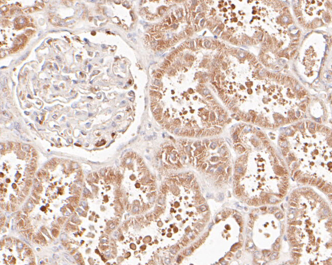 Immunohistochemical analysis of paraffin-embedded human kidney tissue using anti-delta 1 Catenin/CAS antibody. The section was pre-treated using heat mediated antigen retrieval with Tris-EDTA buffer (pH 8.0-8.4) for 20 minutes.The tissues were blocked in 5% BSA for 30 minutes at room temperature, washed with ddH2O and PBS, and then probed with the primary antibody (ER1901-80, 1/200) for 30 minutes at room temperature. The detection was performed using an HRP conjugated compact polymer system. DAB was used as the chromogen. Tissues were counterstained with hematoxylin and mounted with DPX.