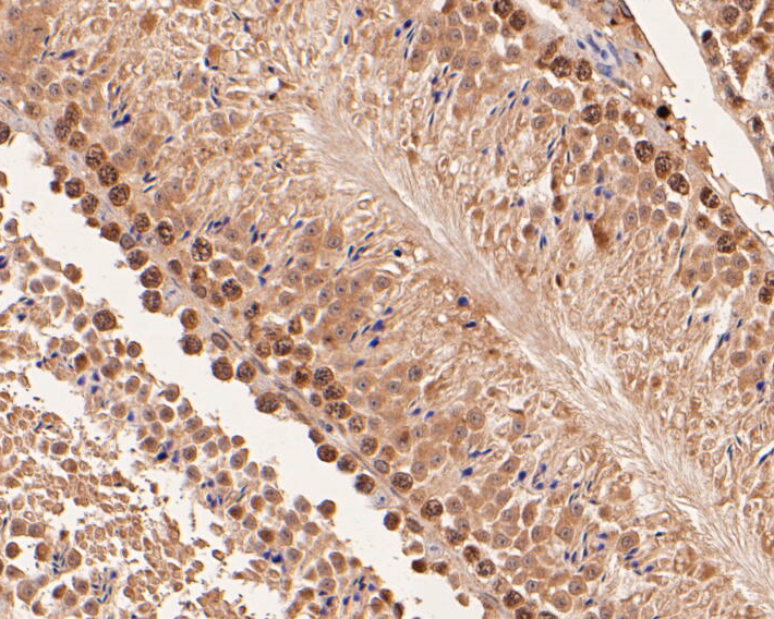 Immunohistochemical analysis of paraffin-embedded mouse testis tissue using anti-delta 1 Catenin/CAS antibody. The section was pre-treated using heat mediated antigen retrieval with Tris-EDTA buffer (pH 8.0-8.4) for 20 minutes.The tissues were blocked in 5% BSA for 30 minutes at room temperature, washed with ddH2O and PBS, and then probed with the primary antibody (ER1901-80, 1/200) for 30 minutes at room temperature. The detection was performed using an HRP conjugated compact polymer system. DAB was used as the chromogen. Tissues were counterstained with hematoxylin and mounted with DPX.