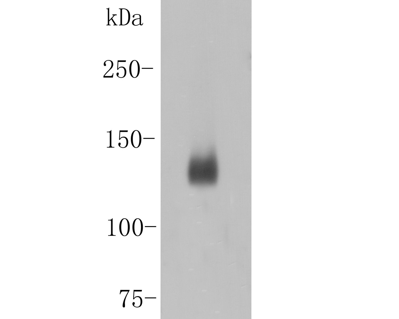 Western blot analysis of Desmoglein 3 on A431 cell lysates with Rabbit anti-Desmoglein 3 antibody (ER1901-81) at 1/500 dilution.<br />
<br />
Lysates/proteins at 10 µg/Lane.<br />
<br />
Predicted band size: 108 kDa<br />
Observed band size: 130 kDa<br />
<br />
Exposure time: 2 minutes;<br />
<br />
6% SDS-PAGE gel.<br />
<br />
Proteins were transferred to a PVDF membrane and blocked with 5% NFDM/TBST for 1 hour at room temperature. The primary antibody (ER1901-81) at 1/500 dilution was used in 5% NFDM/TBST at room temperature for 2 hours. Goat Anti-Rabbit IgG - HRP Secondary Antibody (HA1001) at 1:300,000 dilution was used for 1 hour at room temperature.