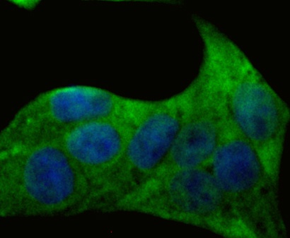 ICC staining DSG3 in Hela cells (green). Formalin fixed cells were permeabilized with 0.1% Triton X-100 in TBS for 10 minutes at room temperature and blocked with 1% Blocker BSA for 15 minutes at room temperature. Cells were probed with the antibody (ER1901-81) at a dilution of 1:200 for 1 hour at room temperature, washed with PBS. Alexa Fluorc™ 488 Goat anti-Rabbit IgG was used as the secondary antibody at 1/100 dilution. The nuclear counter stain is DAPI (blue).