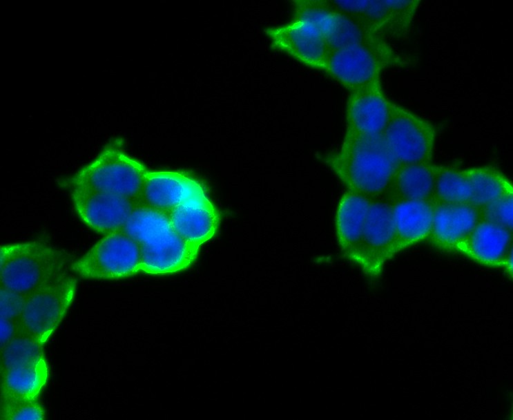 ICC staining of CD35 in 293T cells (green). Formalin fixed cells were permeabilized with 0.1% Triton X-100 in TBS for 10 minutes at room temperature and blocked with 1% Blocker BSA for 15 minutes at room temperature. Cells were probed with the primary antibody (ER1901-82, 1/100) for 1 hour at room temperature, washed with PBS. Alexa Fluor®488 Goat anti-Rabbit IgG was used as the secondary antibody at 1/100 dilution. The nuclear counter stain is DAPI (blue).