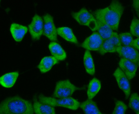 ICC staining of CD35 in F9 cells (green). Formalin fixed cells were permeabilized with 0.1% Triton X-100 in TBS for 10 minutes at room temperature and blocked with 1% Blocker BSA for 15 minutes at room temperature. Cells were probed with the primary antibody (ER1901-82, 1/200) for 1 hour at room temperature, washed with PBS. Alexa Fluor®488 Goat anti-Rabbit IgG was used as the secondary antibody at 1/100 dilution. The nuclear counter stain is DAPI (blue).
