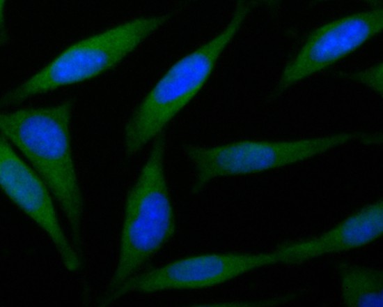 ICC staining of B3GAT1 in SHSY5Y cells (green). Formalin fixed cells were permeabilized with 0.1% Triton X-100 in TBS for 10 minutes at room temperature and blocked with 10% negative goat serum for 15 minutes at room temperature. Cells were probed with the primary antibody (ER1901-83, 1/100) for 1 hour at room temperature, washed with PBS. Alexa Fluor®488 Goat anti-Rabbit IgG was used as the secondary antibody at 1/100 dilution. The nuclear counter stain is DAPI (blue).