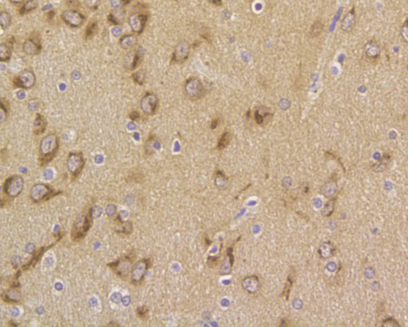 Immunohistochemical analysis of paraffin-embedded Rat brain tissue using anti-B3GAT1 antibody. The section was pre-treated using heat mediated antigen retrieval with Tris-EDTA buffer (pH 9.0) for 20 minutes.The tissues were blocked in 5% BSA for 30 minutes at room temperature, washed with ddH2O and PBS, and then probed with the primary antibody (ER1901-83, 1/100) for 30 minutes at room temperature. The detection was performed using an HRP conjugated compact polymer system. DAB was used as the chromogen. Tissues were counterstained with hematoxylin and mounted with DPX.