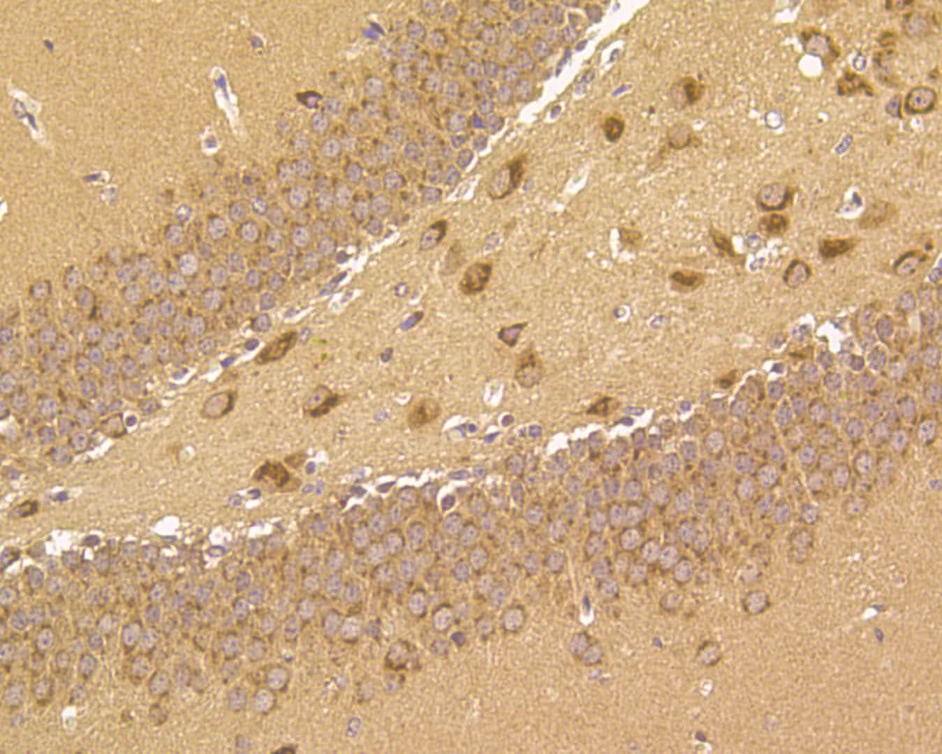 Immunohistochemical analysis of paraffin-embedded mouse brain tissue using anti-B3GAT1 antibody. The section was pre-treated using heat mediated antigen retrieval with Tris-EDTA buffer (pH 9.0) for 20 minutes.The tissues were blocked in 5% BSA for 30 minutes at room temperature, washed with ddH2O and PBS, and then probed with the primary antibody (ER1901-83, 1/100) for 30 minutes at room temperature. The detection was performed using an HRP conjugated compact polymer system. DAB was used as the chromogen. Tissues were counterstained with hematoxylin and mounted with DPX.
