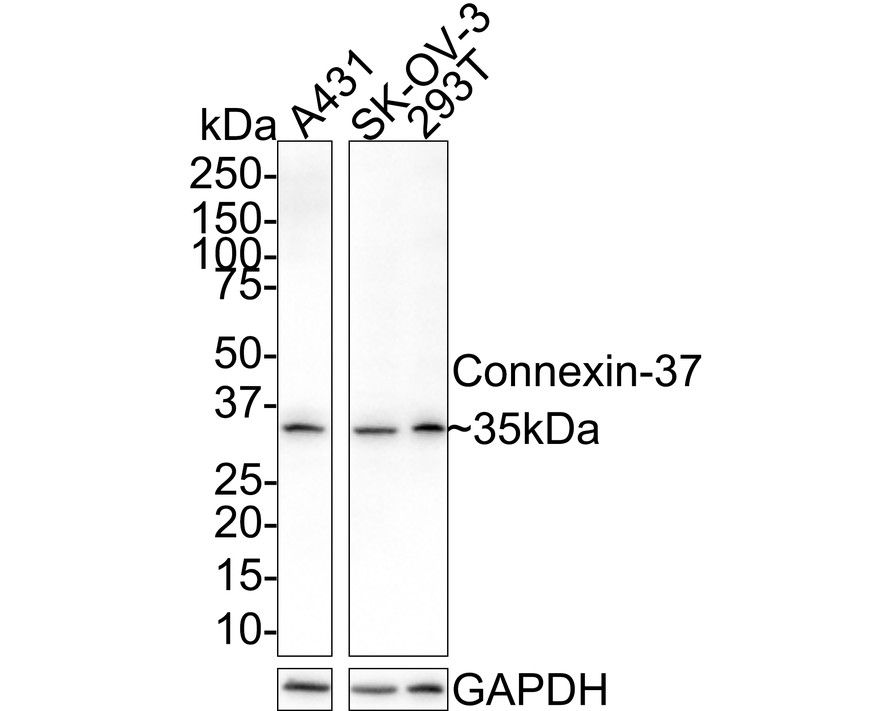 Western blot analysis of Connexin-37 on 293T cell lysate. Proteins were transferred to a PVDF membrane and blocked with 5% BSA in PBS for 1 hour at room temperature. The primary antibody (ER1901-85, 1/500) was used in 5% BSA at room temperature for 2 hours. Goat Anti-Rabbit IgG - HRP Secondary Antibody (HA1001) at 1:5,000 dilution was used for 1 hour at room temperature.